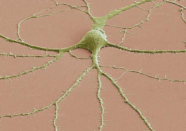 Geek Alert: Brain Cells Under A Microscope!