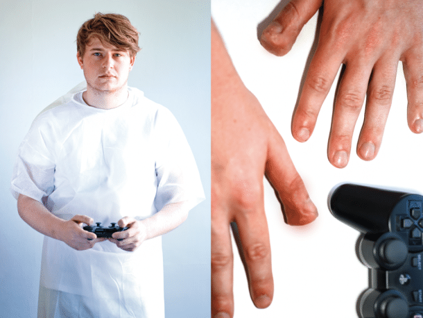 Gaming Injuries: It’s A Dangerous Business