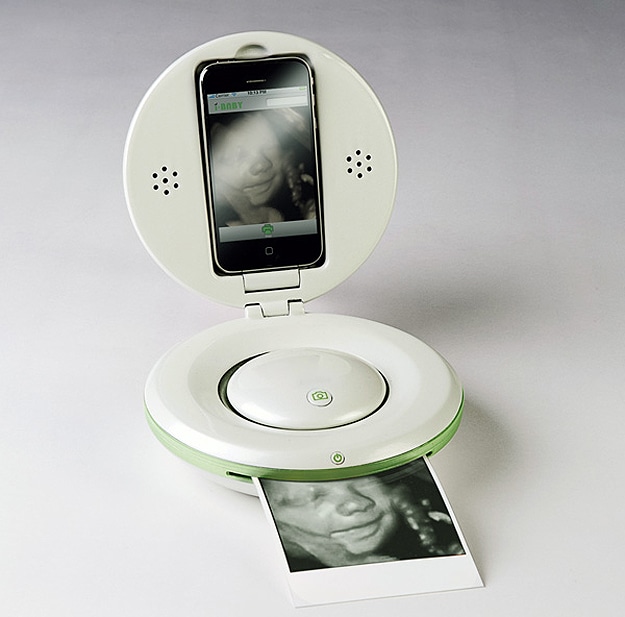 iBaby: The First Smartphone Home Ultrasound Device