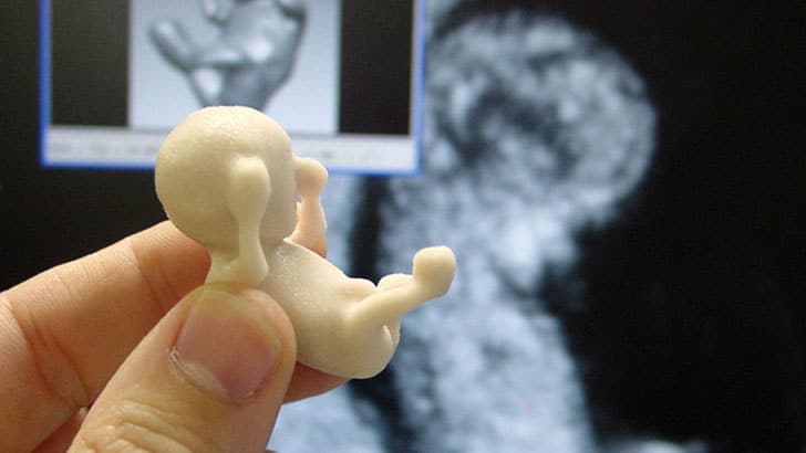 Hold A Life-Size Model Of Your Unborn Baby With This 3D Sonogram
