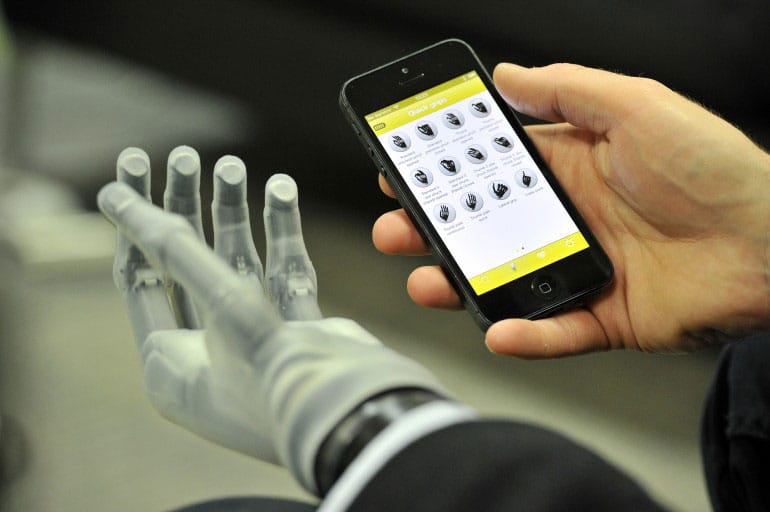 World’s First App-Controlled Prosthetic Hand Allows Natural Functions