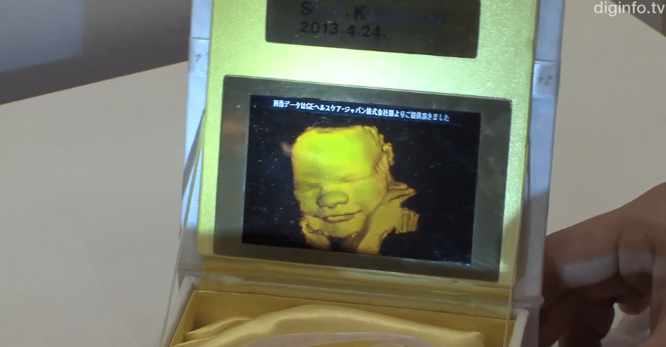 3D Ultrasound Service Offers Printed Baby Hologram Pictures