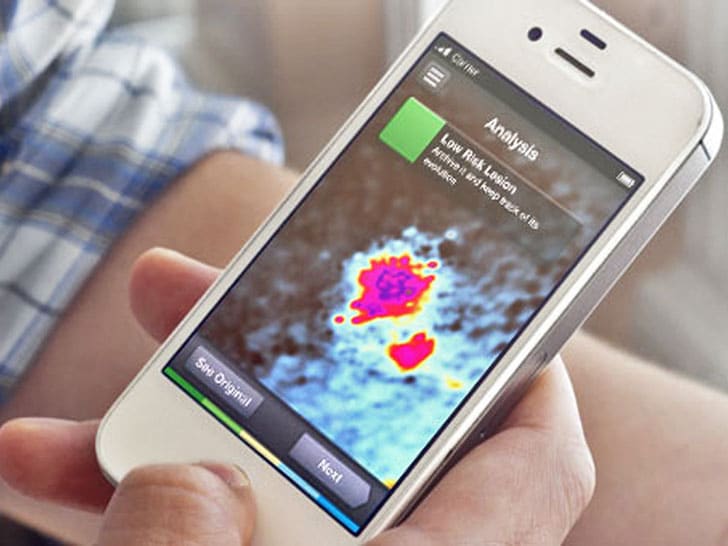 SkinVision App Turns Your Smartphone Into A Skin Cancer Scanner