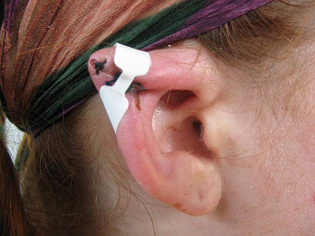 Dedicated Geeks Go All Out To Get Elven Ears